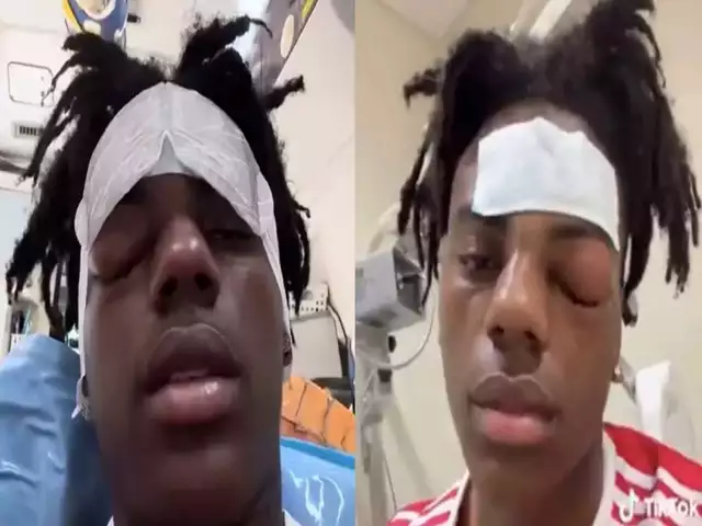 IShowSpeed eye injury update: An American YouTuber undergoes surgery after experiencing 'cluster headaches'